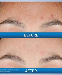 CeraVe Resurfacing Retinol Face Serum with Niacinamide, Pore Minimizer, 1oz | Skin Care Brightening Serum with Licorice Root, Acne Scar & Hyperpigmentation Treatment, Dark Spot...-Bitadi