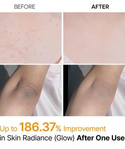Dr.Melaxin Peel Shot Kojic Acid Turmeric Body Exfoliator Spray 6.76 fl.oz - AHA PHA Niacinamide Body Scrub for KP Bumps, Dark Spots, Uneven Skin Tone, Dead Skin, Korean Skin Care-Bitadi