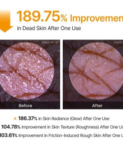 Dr.Melaxin Peel Shot Kojic Acid Turmeric Body Exfoliator Spray 6.76 fl.oz - AHA PHA Niacinamide Body Scrub for KP Bumps, Dark Spots, Uneven Skin Tone, Dead Skin, Korean Skin Care-Bitadi