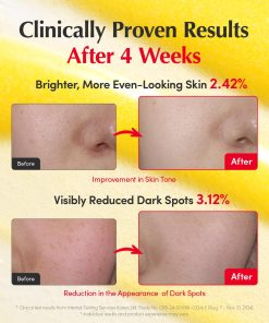 EQQUALBERRY Vitamin Illuminating Serum | Niacinamide 4% & TXA | Brightening Vitamin C Serum for Face Glow with Hyaluronic Acid | Dark Spot & Uneven Tone Care | Korean Skincare,...