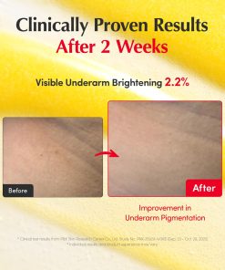 EQQUALBERRY Vitamin Illuminating Serum | Niacinamide 4% & TXA | Brightening Vitamin C Serum for Face Glow with Hyaluronic Acid | Dark Spot & Uneven Tone Care | Korean Skincare,...