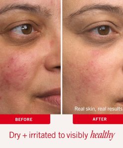First Aid Beauty Ultra Repair Cream, Intense Hydration-Bitadi