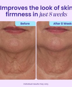 goPure Tighten & Lift Neck & Chest Moisturizer Cream for Visibly Firming, Tightening and Lifting the Look of Wrinkles & Crepey Skin, 1.7oz-Bitadi