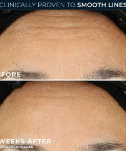 RoC Retinol Correxion Anti-Aging Wrinkle Night Serum Capsules, 30 count-Bitadi