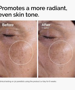 The Ordinary Glycolic Acid 7% Exfoliating Toner, Brightening and Smoothing Daily Toner for More Even-Looking Skin Tone 21 The Ordinary Glycolic Acid 7% Exfoliating Toner, Brightening and Smoothing Daily Toner for More Even-Looking Skin Tone
