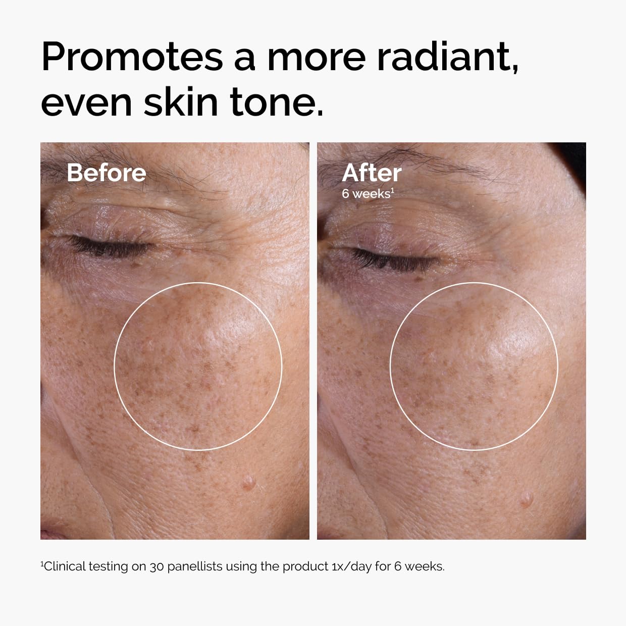 The Ordinary Glycolic Acid 7% Exfoliating Toner, Brightening and Smoothing Daily Toner for More Even-Looking Skin Tone 13 The Ordinary Glycolic Acid 7% Exfoliating Toner, Brightening and Smoothing Daily Toner for More Even-Looking Skin Tone