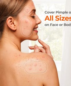 TKTK 443 Count Pimple Patches for Face, Hydrocolloid Acne Cover Patch Bulk