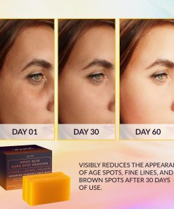 VALITIC Kojic Acid Dark Spot Remover Soap Bars, Turmeric Bar Soaps 2 Pack